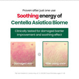 Skin Concern- Sensitive Skin/ Redness