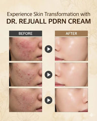 Reju All- Advanced PDRN 20g